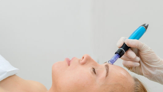 fillers vs microneedling