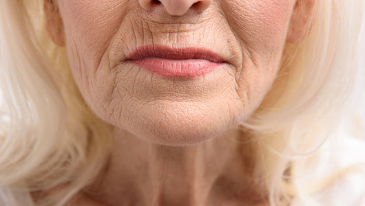 microneedling for smokers lines
