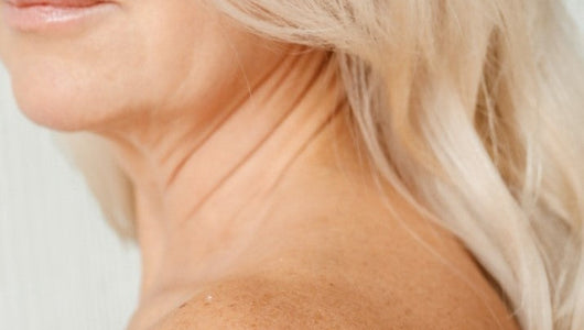 microneedling double chin