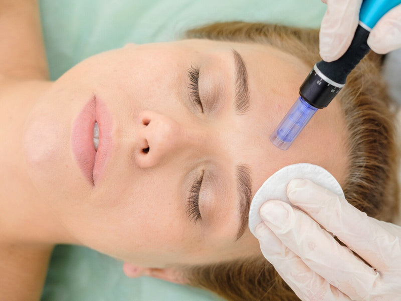 track marks after microneedling
