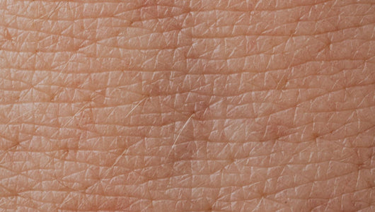 microneedling for hyperpigmentation