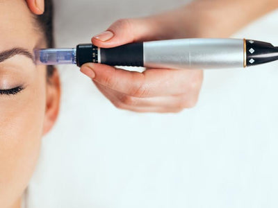 micro needling for pitted scars