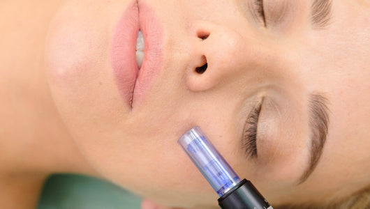 Botox vs microneedling