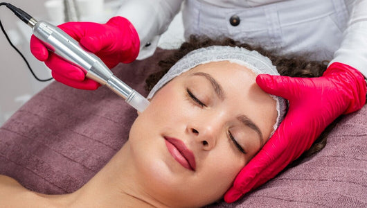 PRP vs microneedling