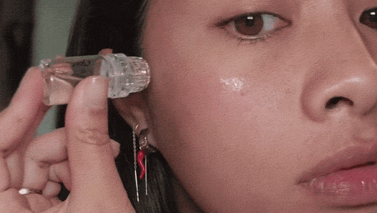 Why Redness After Micro-Infusion is a Good Sign