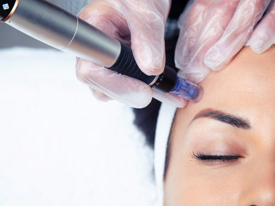 itching after microneedling