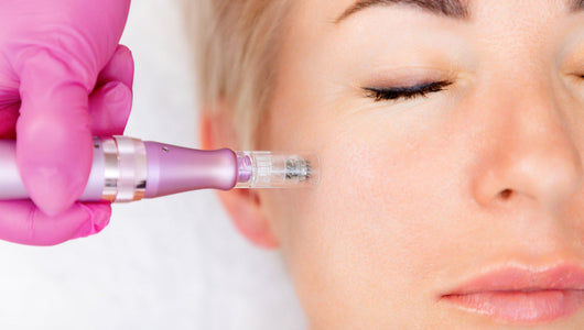 microneedling for textured skin