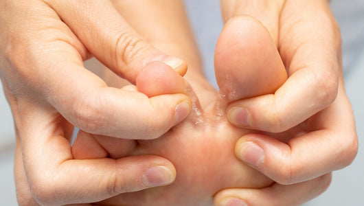 does red light therapy kill fungus