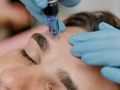 microneedling men