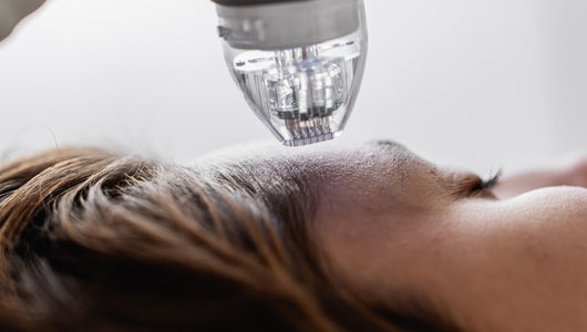 microneedling while breastfeeding