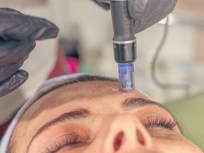 what does microneedling feel like