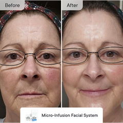 Line Refine Bundle Pro