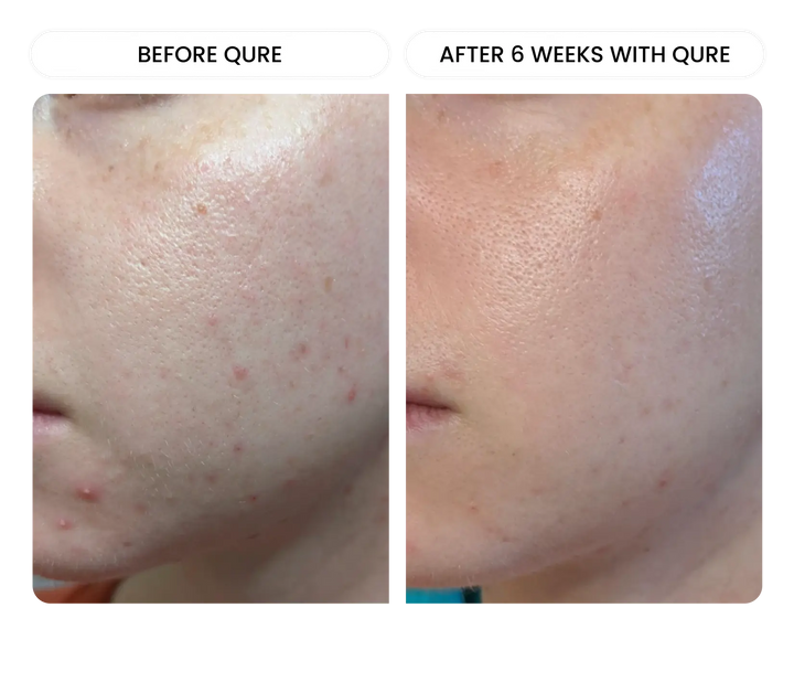 All-In-One Face Serum 6-Month Bundle