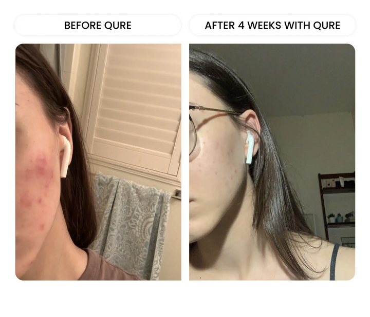 All-In-One Face Serum 6-Month Bundle