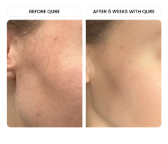 All-In-One Face Serum 6-Month Bundle