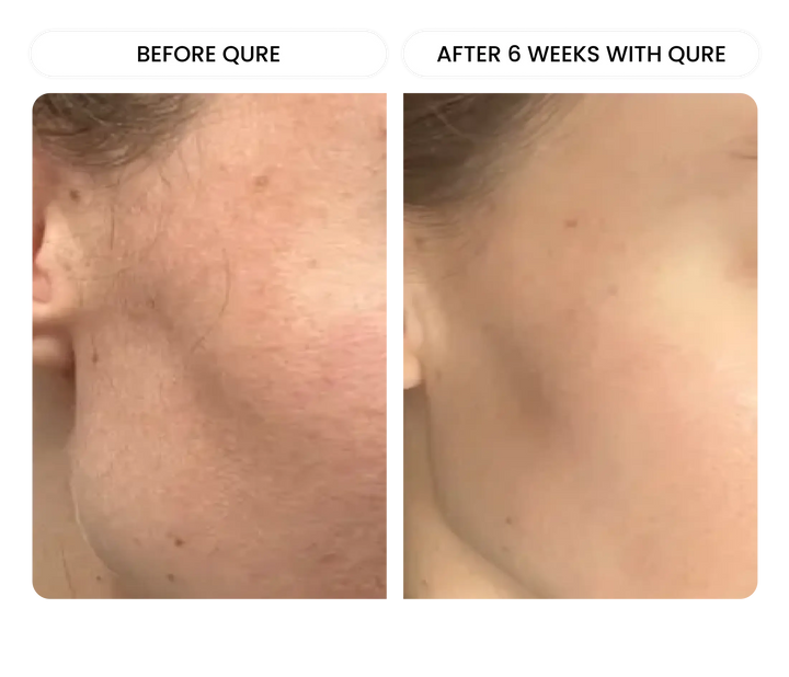 All-In-One Face Serum 6-Month Bundle