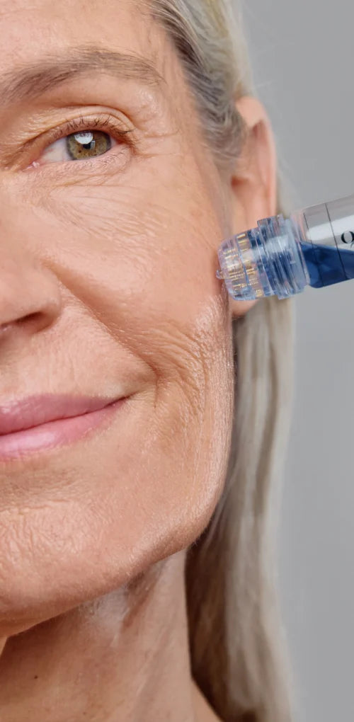 Signs of Aging