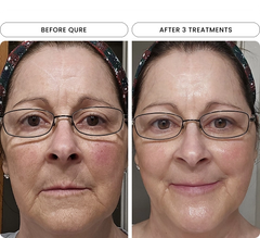 dark spots reduced