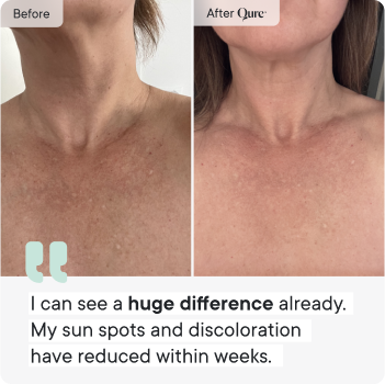 Neck & Décolletage System (Pre-Order)