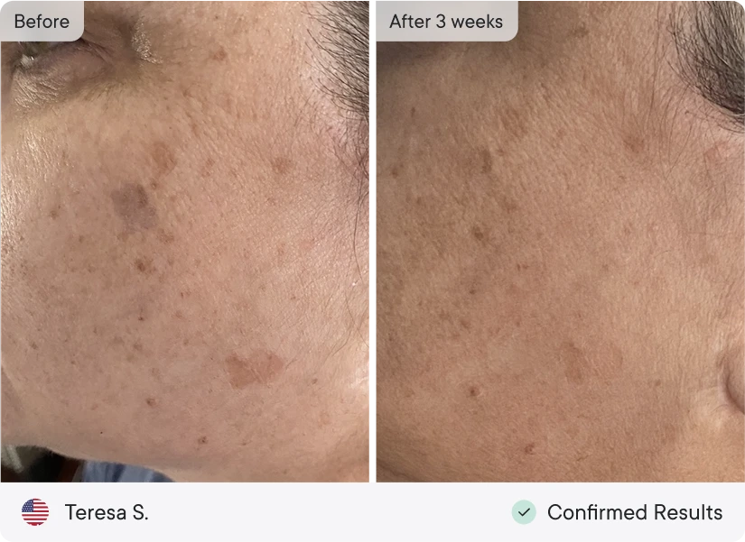 before & after 3 weeks