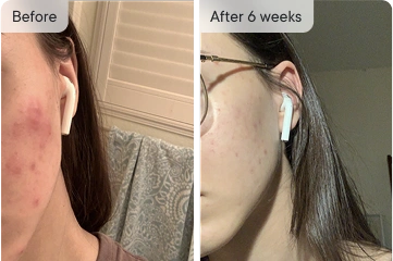 Before & after 6 weeks